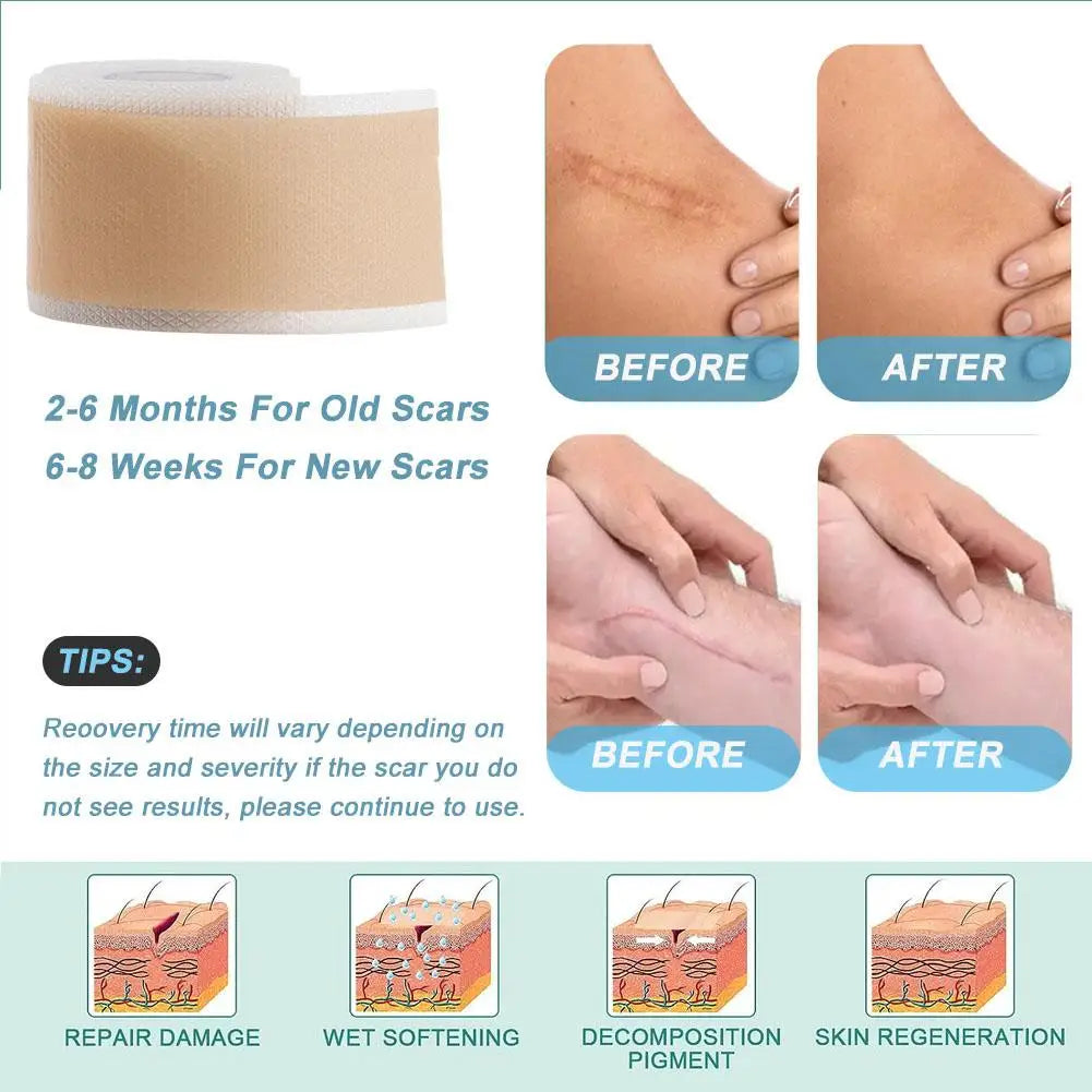 Silk Skin Tape