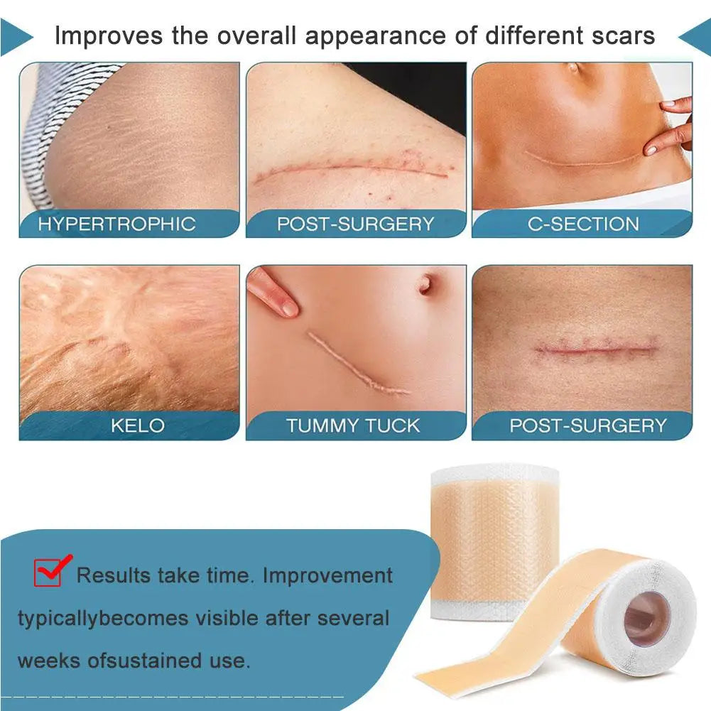 Silk Skin Tape
